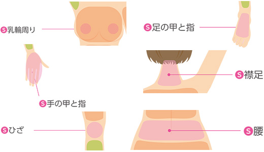 脱毛メニュー